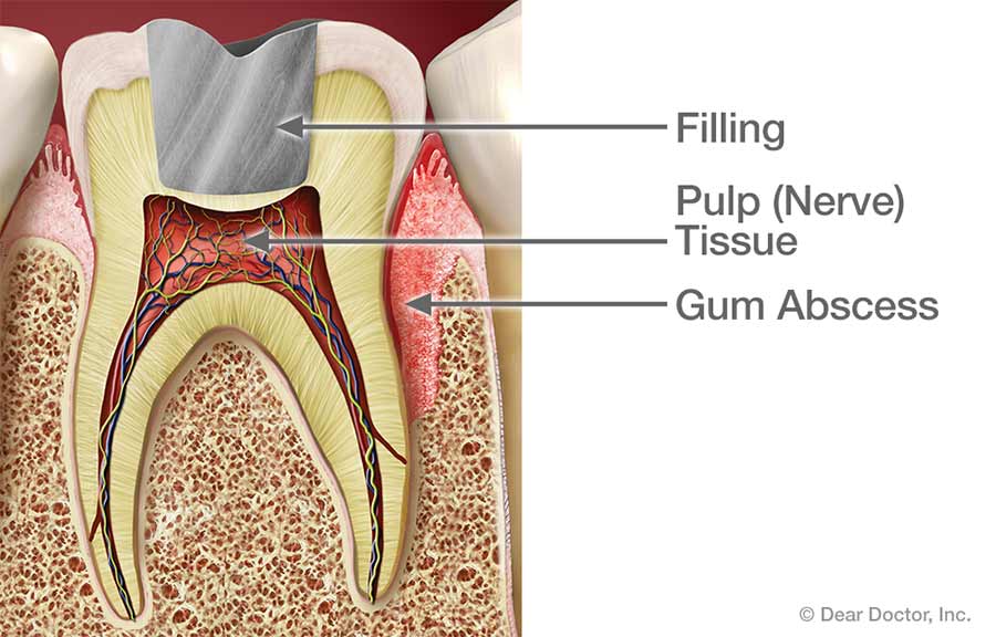 Gum Injuries